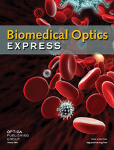 biomedical optics express bmoe