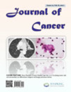 Journal of Cancer怎么样