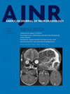 AMERICAN JOURNAL OF NEURORADIOLOGY：3.5分、医学2区，神经影像领域老牌期刊，非OA模式下的投稿价值分析